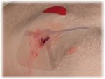 Hyfin Vent Chest Seal Twin Pack - Image 7